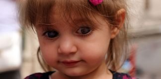 Sol gözünü tamamen kaybetme riski olan Simay bebek yardım eli bekliyor