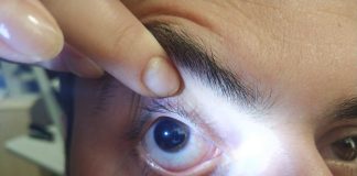 Spor yaparken göz bebeğini parçaladı