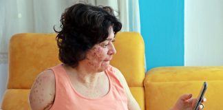 Artık telefondaki filtreler bile yüzü için yetersiz kalıyor